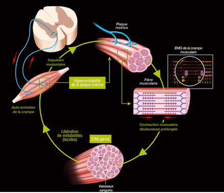 Electromyography