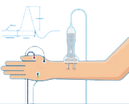 NERVE CONDUCTION STUDIES NERVE CONDUCTION STUDIES